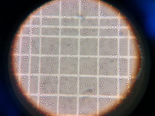 Vista a través de microscopi de ferments ecològics per produir llevats ecològiques pròpies.