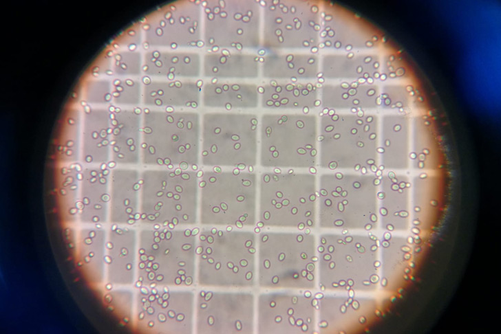 Vista a través de microscopio de fermentos ecológicos para producir levaduras ecológicas propias.